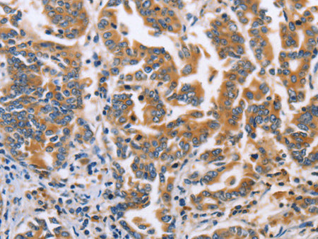 DOK4 Polyclonal Antibody Store at -20°C - MSE Supplies LLC