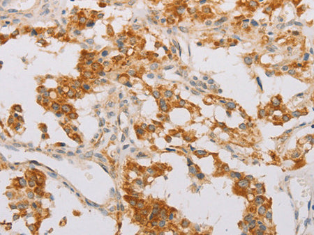 STK40 Polyclonal Antibody Store at -20°C - MSE Supplies LLC