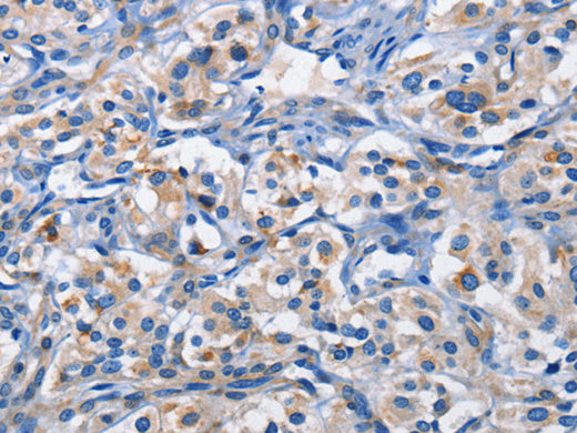 PIM1 Polyclonal Antibody Store at -20°C - MSE Supplies LLC