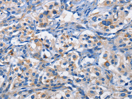 PIM1 Polyclonal Antibody Store at -20°C - MSE Supplies LLC