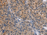 MAP3K13 Polyclonal Antibody Store at -20°C - MSE Supplies LLC