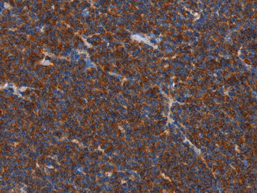 FNK Polyclonal Antibody Store at -20°C - MSE Supplies LLC
