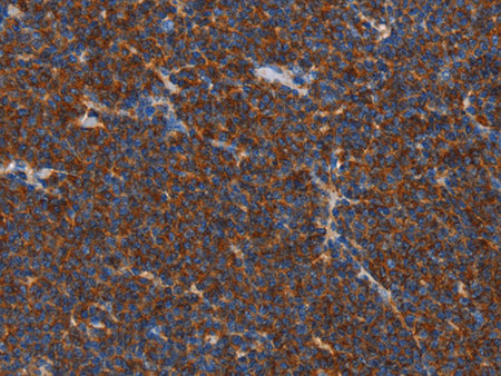 FNK Polyclonal Antibody Store at -20°C - MSE Supplies LLC