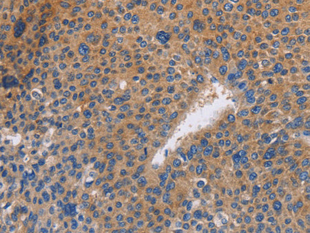 NEK8 Polyclonal Antibody Store at -20°C - MSE Supplies LLC