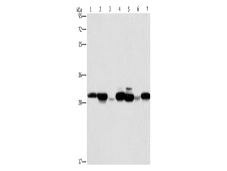 AK2 Polyclonal Antibody Store at -20°C - MSE Supplies LLC