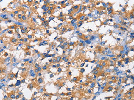 PFKP Polyclonal Antibody Store at -20°C - MSE Supplies LLC