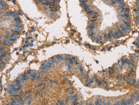 HK3 Polyclonal Antibody Store at -20°C - MSE Supplies LLC