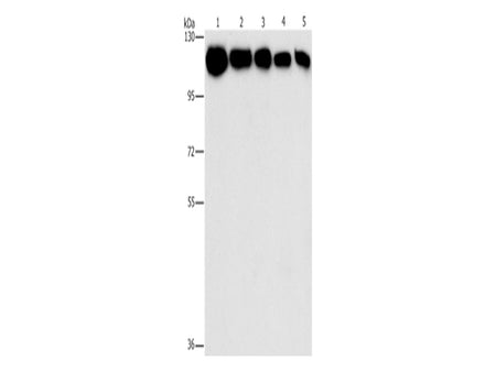 HK2 Polyclonal Antibody Store at -20°C - MSE Supplies LLC