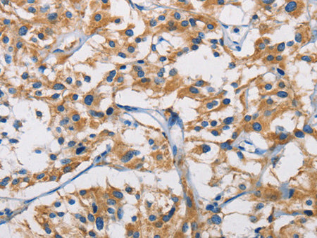 HK1 Polyclonal Antibody Store at -20°C - MSE Supplies LLC