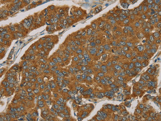 NPPB Polyclonal Antibody Store at -20°C - MSE Supplies LLC