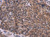 CDC5L Polyclonal Antibody Store at -20°C - MSE Supplies LLC