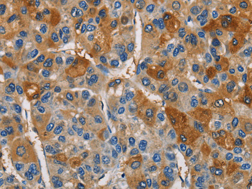 CST4 Polyclonal Antibody Store at -20°C - MSE Supplies LLC