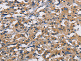 CBY1 Polyclonal Antibody Store at -20°C - MSE Supplies LLC