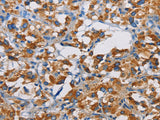 TSPEAR Polyclonal Antibody Store at -20°C - MSE Supplies LLC