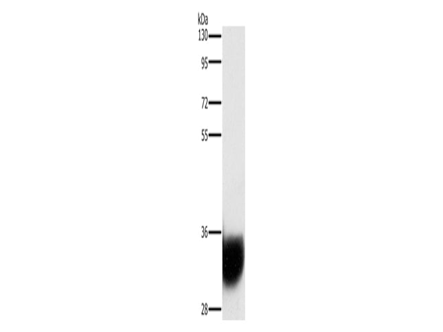 GPM6A Polyclonal Antibody Store at -20°C - MSE Supplies LLC