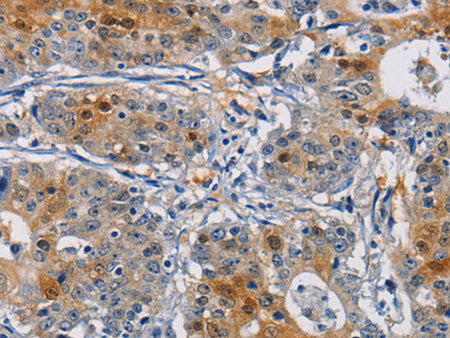 GSTA2 Polyclonal Antibody Store at -20°C - MSE Supplies LLC