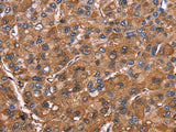 ELP2 Polyclonal Antibody Store at -20°C - MSE Supplies LLC