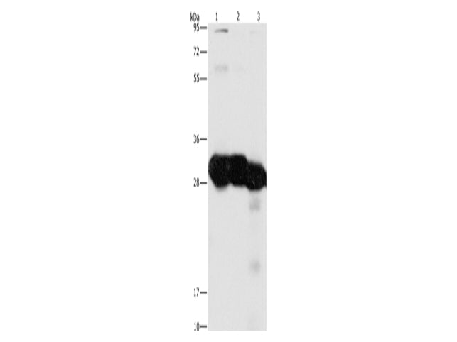 KHK Polyclonal Antibody Store at -20°C - MSE Supplies LLC