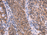 EIF2AK4 Polyclonal Antibody Store at -20°C - MSE Supplies LLC
