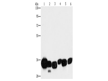 CBR1 Polyclonal Antibody Store at -20°C - MSE Supplies LLC