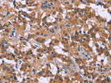 PIP5K1B Polyclonal Antibody Store at -20°C - MSE Supplies LLC