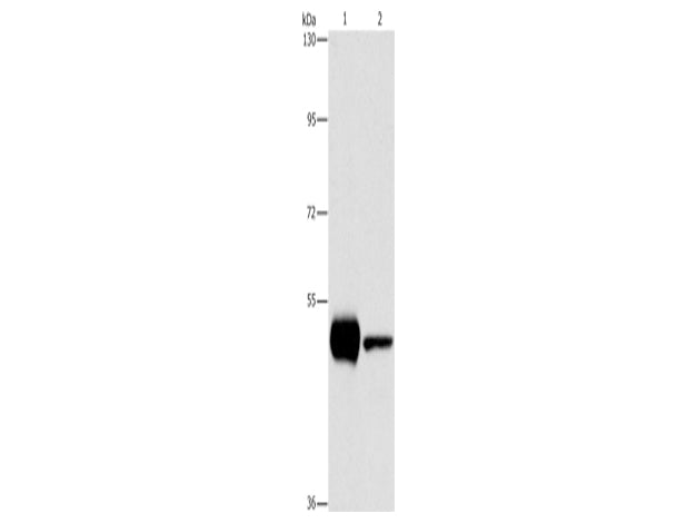 PIP4K2A Polyclonal Antibody Store at -20°C - MSE Supplies LLC