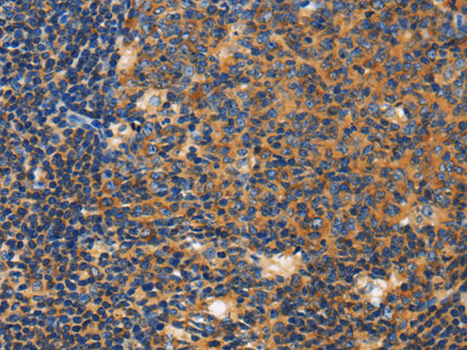 CERK Polyclonal Antibody Store at -20°C - MSE Supplies LLC