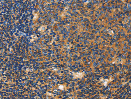 CERK Polyclonal Antibody Store at -20°C - MSE Supplies LLC