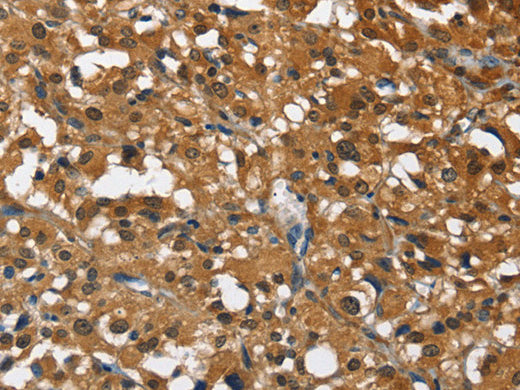 DRAK2 Polyclonal Antibody Store at -20°C - MSE Supplies LLC