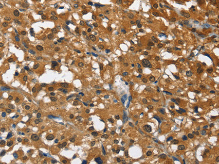 DRAK2 Polyclonal Antibody Store at -20°C - MSE Supplies LLC