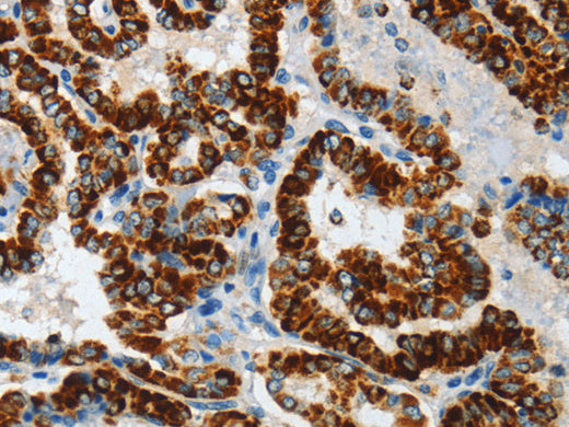 ASB4 Polyclonal Antibody Store at -20°C - MSE Supplies LLC