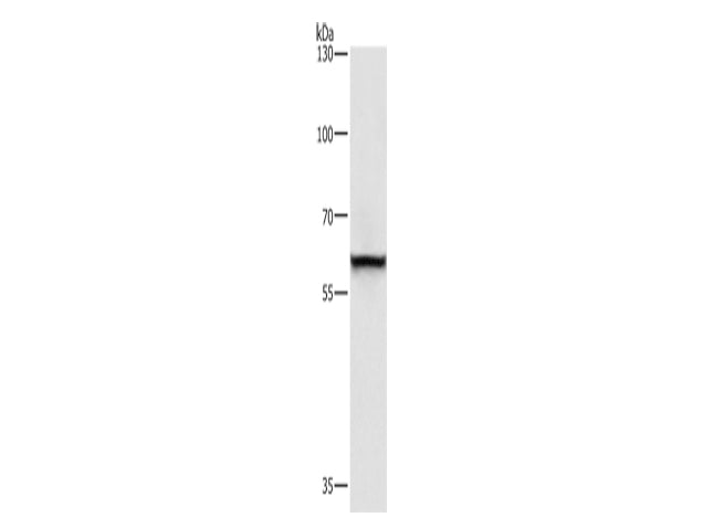 TRIP4 Polyclonal Antibody Store at -20°C - MSE Supplies LLC