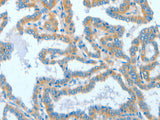 ASCC1 Polyclonal Antibody Store at -20°C - MSE Supplies LLC