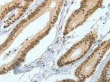 ASH2L Polyclonal Antibody Store at -20°C - MSE Supplies LLC