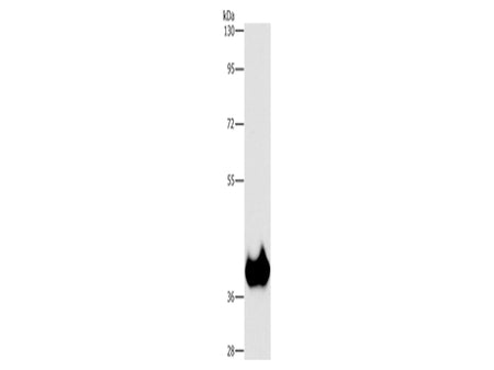 ASPA Polyclonal Antibody Store at -20°C - MSE Supplies LLC