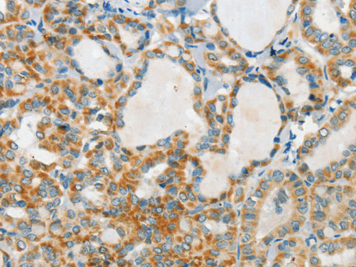 AANAT Polyclonal Antibody Store at -20°C - MSE Supplies LLC