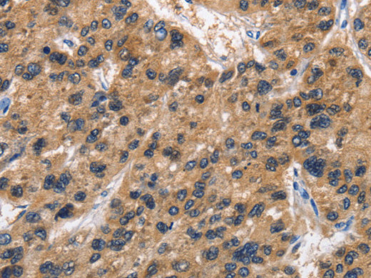 ABI3BP Polyclonal Antibody Store at -20°C - MSE Supplies LLC