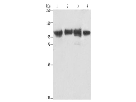 ACTN4 Polyclonal Antibody Store at -20°C - MSE Supplies LLC