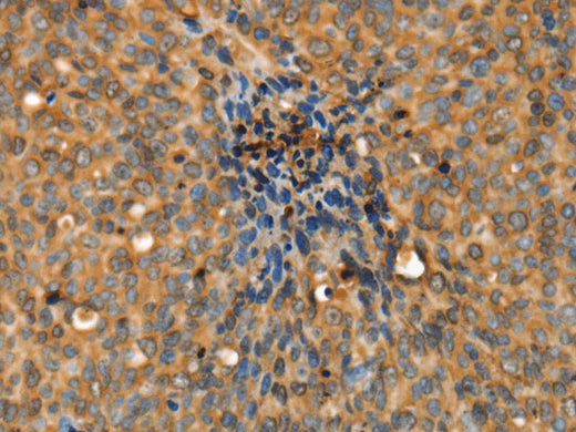 ADCY3 Polyclonal Antibody Store at -20°C - MSE Supplies LLC