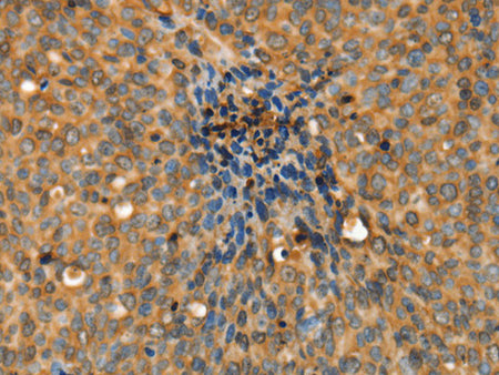 ADCY3 Polyclonal Antibody Store at -20°C - MSE Supplies LLC