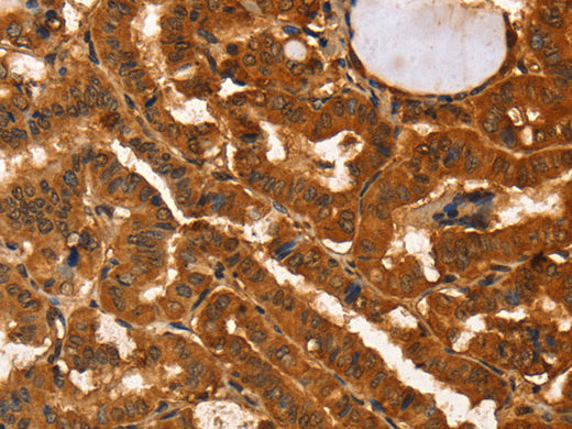 IKZF3 Polyclonal Antibody Store at -20°C - MSE Supplies LLC