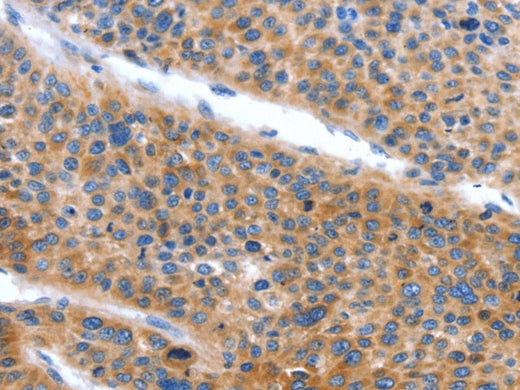 ARL11 Polyclonal Antibody Store at -20°C - MSE Supplies LLC