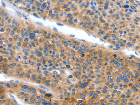 ARL11 Polyclonal Antibody Store at -20°C - MSE Supplies LLC