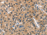 ASB2 Polyclonal Antibody Store at -20°C - MSE Supplies LLC