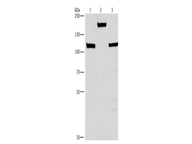 TP53BP2 Polyclonal Antibody Store at -20°C - MSE Supplies LLC