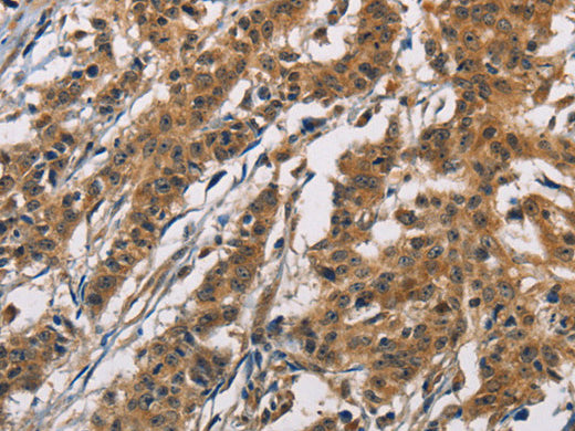 ATP2C1 Polyclonal Antibody Store at -20°C - MSE Supplies LLC