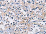 ATP6AP2 Polyclonal Antibody Store at -20°C - MSE Supplies LLC