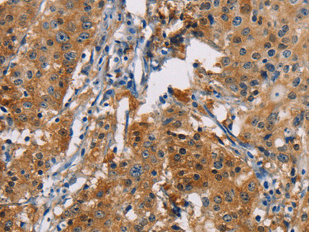 PDCD1LG2 Polyclonal Antibody Store at -20°C - MSE Supplies LLC