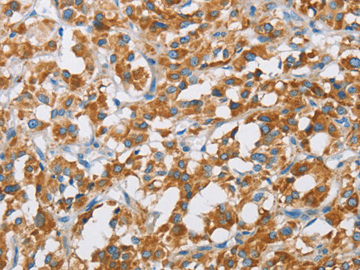 BDH1 Polyclonal Antibody Store at -20°C - MSE Supplies LLC