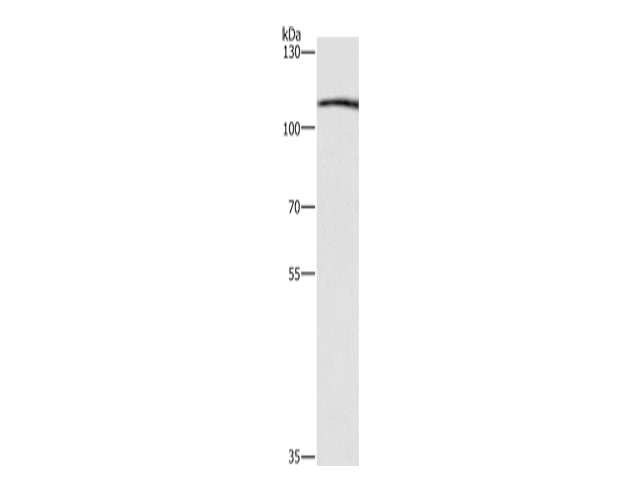COPB1 Polyclonal Antibody Store at -20°C - MSE Supplies LLC